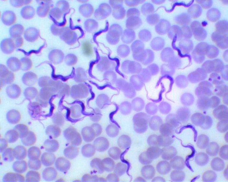 Trypanosoma rhodesiense в мазке крови