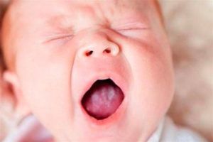 Молочница на языке у ребенка