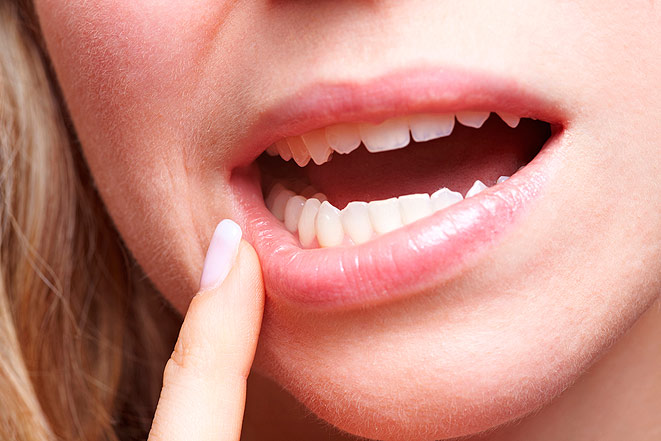 Режется зуб мудрости, больно глотать? Причины и способы лечения