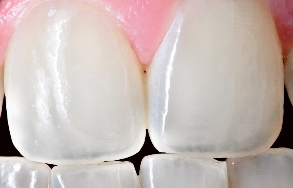 Прозрачные зубы