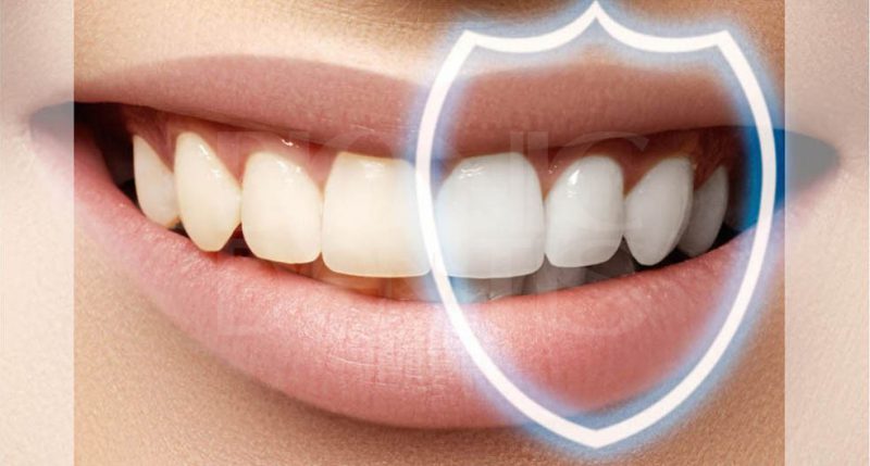 как укрепить зубы дома