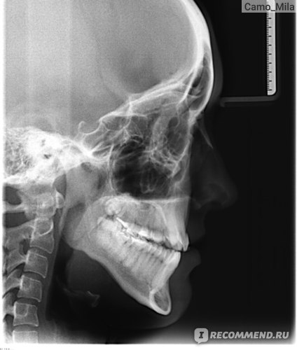 Ортопанорама профиль