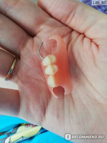 Съемные зубные протезы фото
