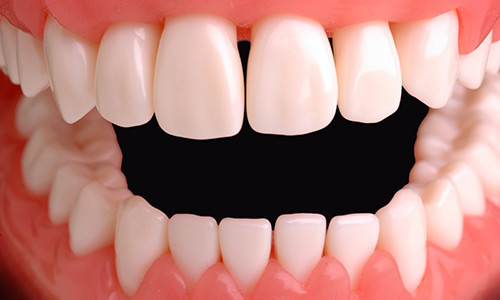 Зубы человека