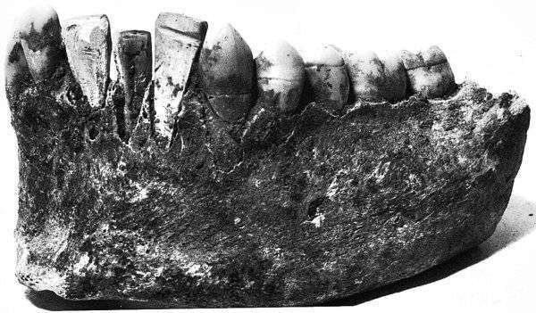 Фрагмент нижней челюсти 20летней индианки из племени Майя