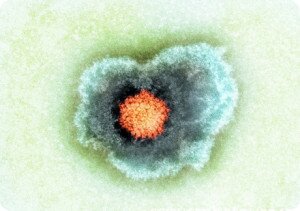 Вирус герпеса на фото