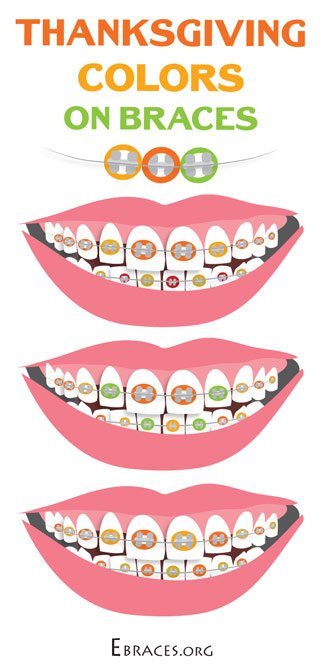braces color combinations