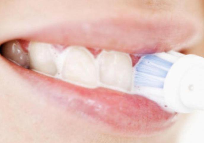 почему кровоточат десна при чистке зубов