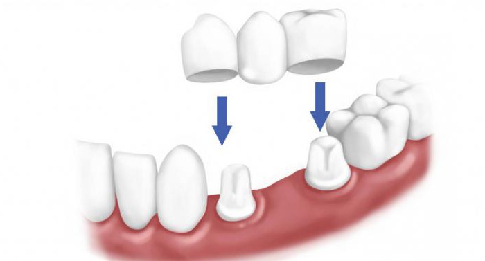 ЭОД в стоматологии отзывы