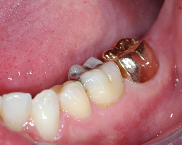показания ЭОД в стоматологии