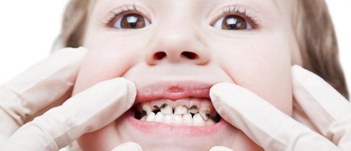 разрушение зубов у детей 