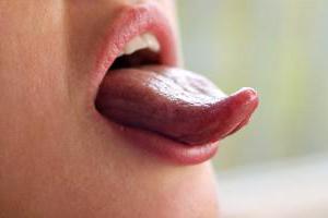 воспаление слюнной железы под языком