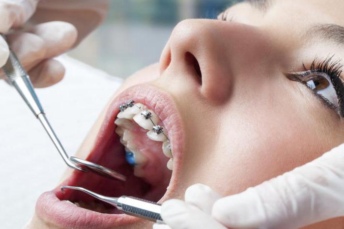 правильный и неправильный прикус зубов у человека