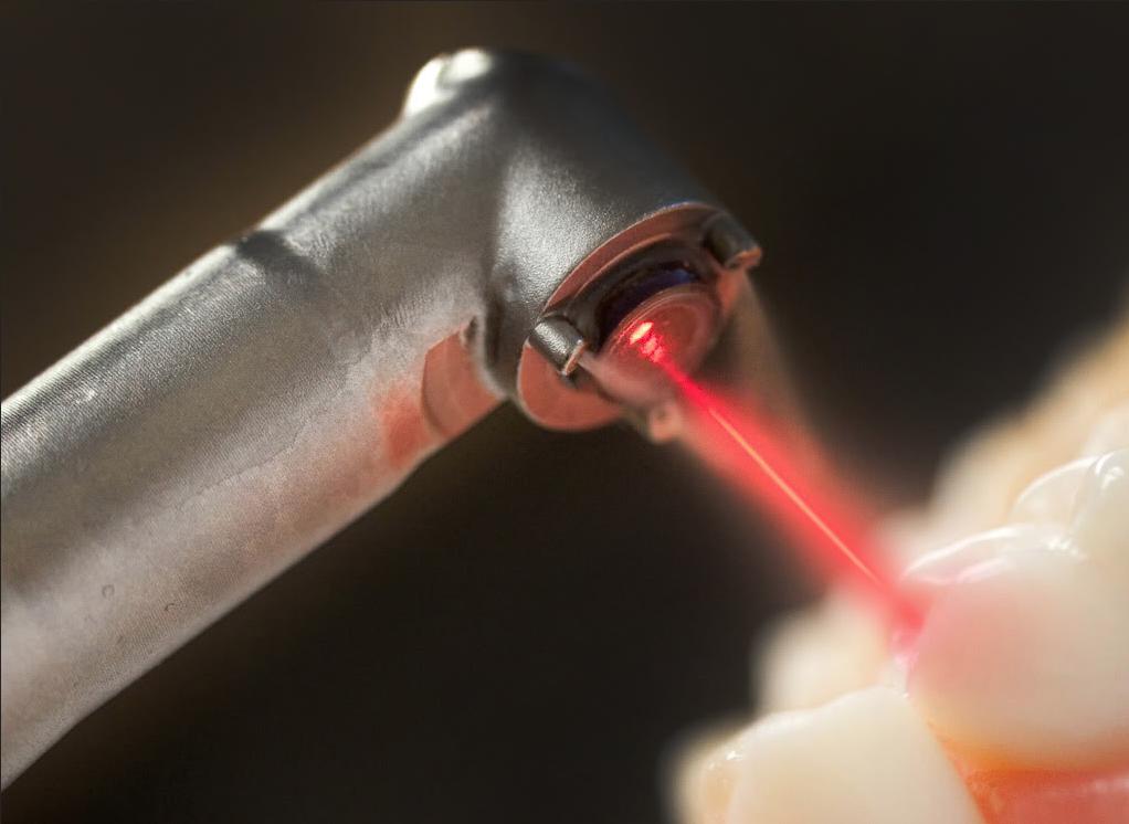 диодный лазер в стоматологии