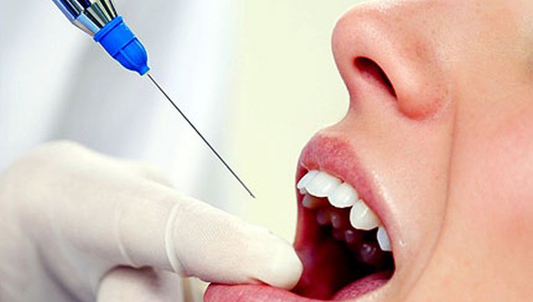 зубная анестезия