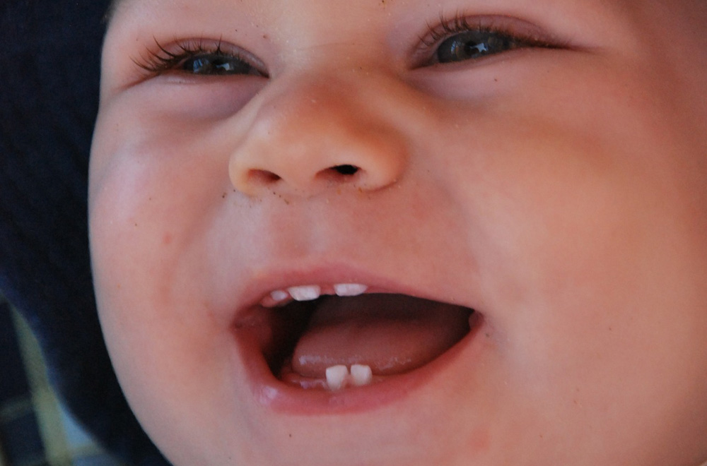 почему у ребенка в 8 месяцев нету зубов