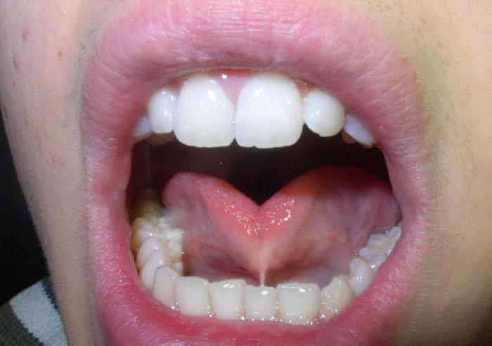 анатомия полость рта 