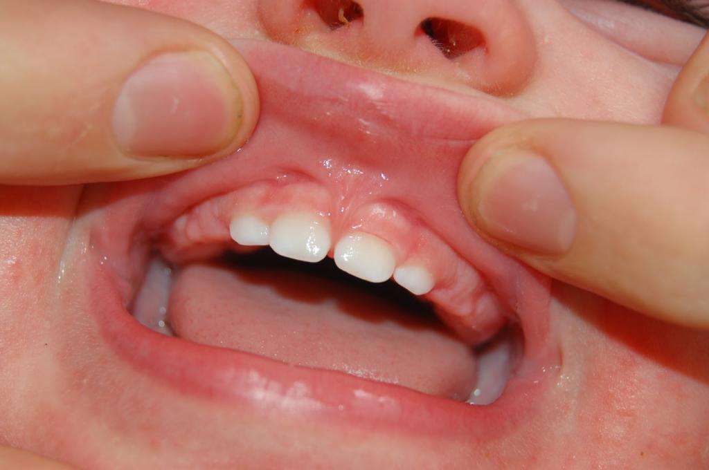 Детская хирургическая стоматология