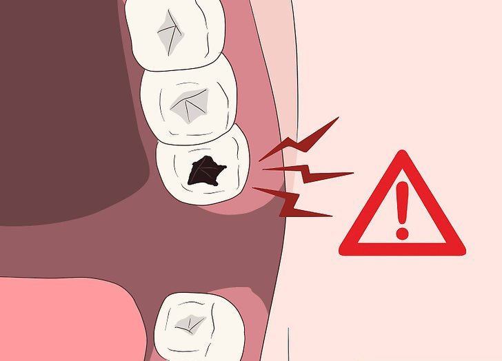 Причины появления зубной боли у ребенка