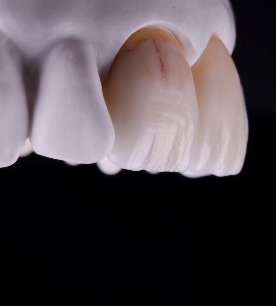 форма зубов моделирование