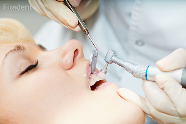 Механическая чистка гигиены зубов и ротовой полости