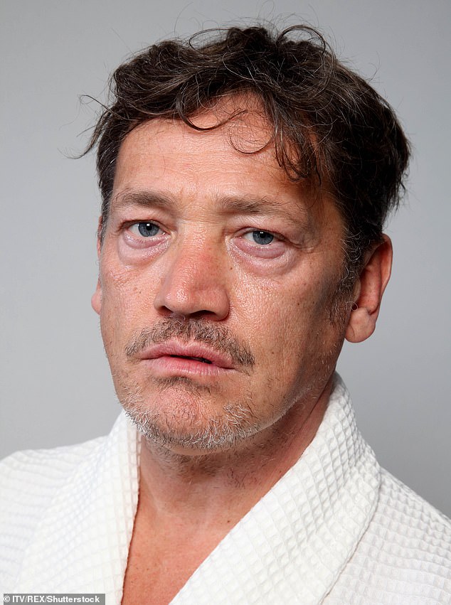 Agony: Actor Sid Owen has found himself stranded in Thailand with a shattered jaw after a golf ball thwacked him in the face and knocked out six of his teeth [pictured in 2018]
