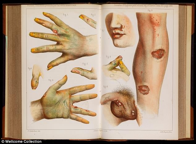 Pictured: Accidents caused by the use of green arsenic, 1859. Arsenic was commonly used in the 19th century for oil paints and lacquers