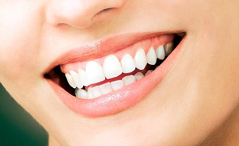 Veneers: What price a bright, white smile? (File picture)