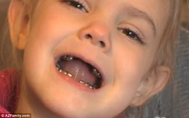 Embarrassed: The four-year-old has repeatedly told her mother that she did not like her new smile after a dentist gave her silver fillings
