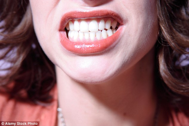 Even without problems, veneers cost £350 to £1,000 each, so getting both rows treated can cost £16,000