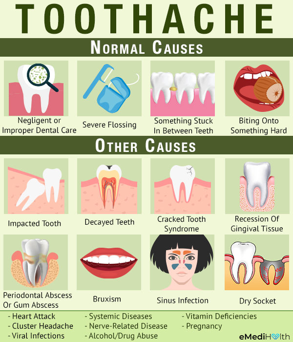 causes of toothache