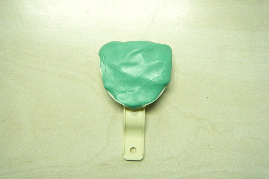 dental impression procedure: impression material is placed in the impression tray