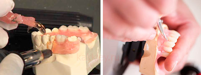 Самостоятельный ремонт зубного протеза