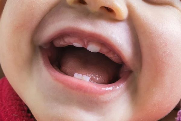 Режутся зубы у малыша