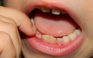 Какие зубы у детей молочные, есть ли у них корни, как их отличить от постоянных единиц?
