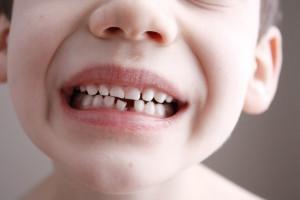Что делать, если выпал первый молочный зуб у ребенка, можно ли его хранить: обычаи и приметы