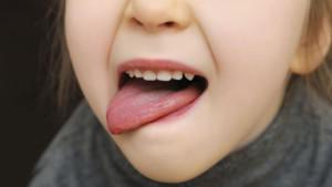 Строение и особенности слизистой оболочки полости рта, элементы поражения и профилактика заболеваний