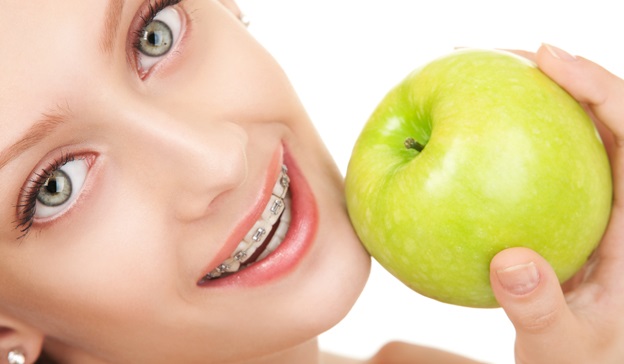 Любительницам покусать хрустящие зеленые яблочки придется привыкать к ножу, дабы случайно при надкусывании не отклеить брекет