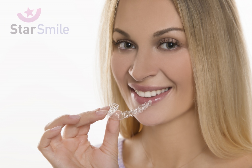 Элайнеры Star Smile - прекрасная альтернатива лечению на брекетах