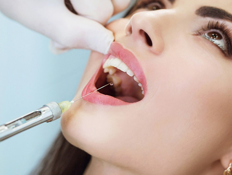Анестезия в стоматологии: 4 самых безопасных препарата для проведения анестезии