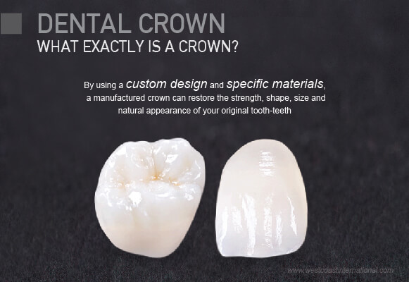 Dental Crowns Westcoast International Dental Clinic