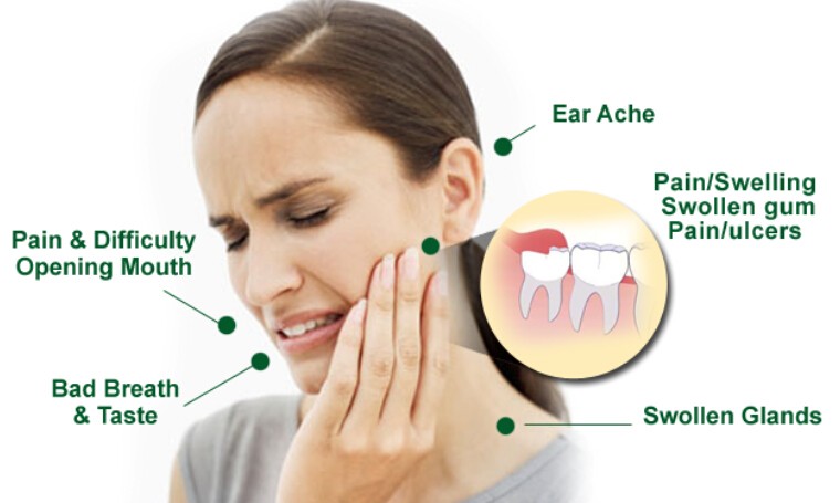 wisdom-teeth-pain-symptoms