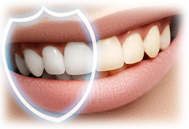 как восстановить зубную эмаль