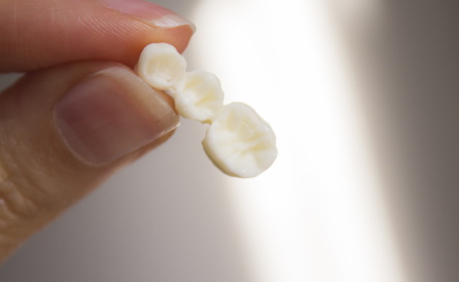 Фото керамических зубов