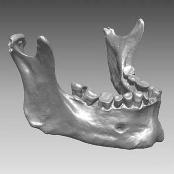 анатомия нижней челюсти человека 