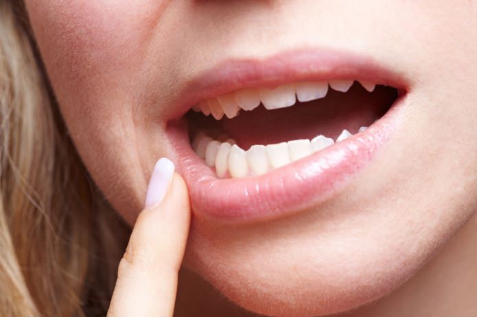Индексы гигиены полости рта