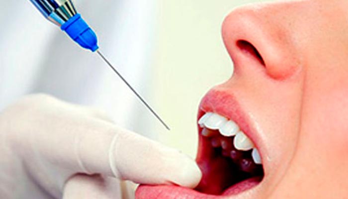анестезия стоматолог
