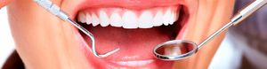 Как выбрать стоматологическую клинику для лечения гингивита