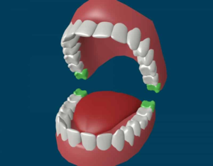 Количество зубов у взрослого человека, вместе с зубами мудрости - 32