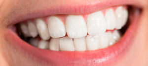 Здоровая эмаль - лучшая защита зубов